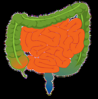 Vivir con SHA · Mi Historia · Síndrome del Intestino Irritable
