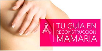 Guía para la reconstrucción mamaria después de un cáncer