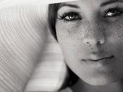 Pecas… ¿nos gustan