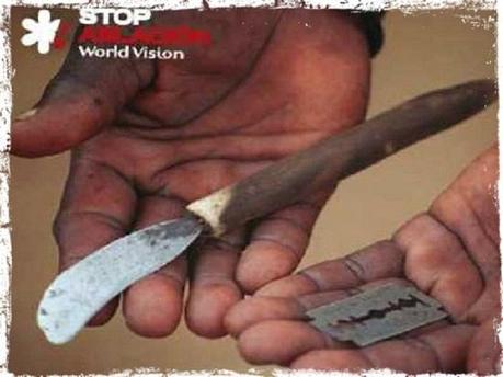 La ablación del clítoris La ablación del clítoris