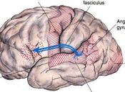 Apraxia. Causas síntomas