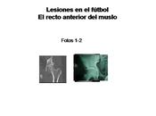 recto anterior muslo futbolista