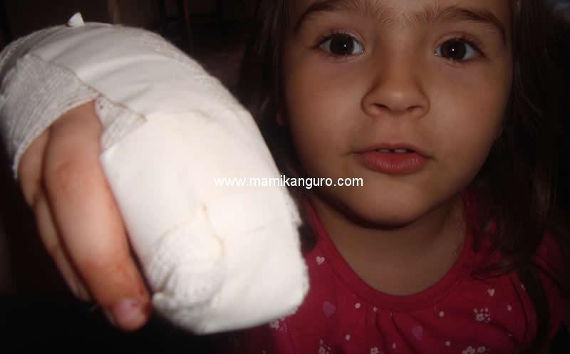 De accidentes domésticos y otras yerbas