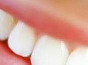 Dientes blancos