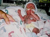 Desarrollan cinta adhesiva para tratamientos médicos especial bebés