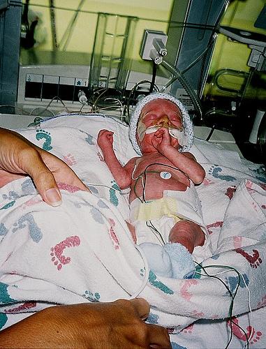 Desarrollan cinta adhesiva para tratamientos médicos especial para bebés