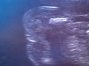 Pues aquí resultado