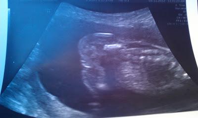 Pues e aquí el resultado