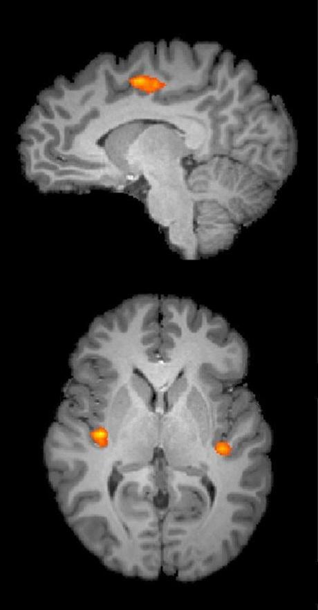 Cuando estamos ansiosos por las matemáticas nuestro cerebro siente dolor