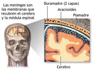 Formas y alternativas para tratar a la meningitis