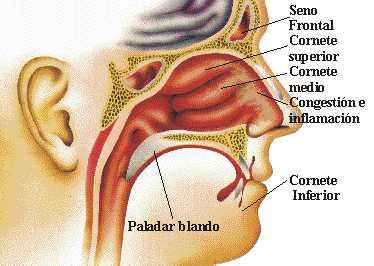 Los síntomas más conocidos en la rinitis