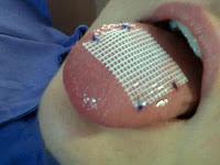 Malla Supralingual para perder Peso