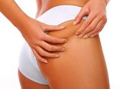 Consejos para reducir celulitis