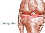 consejos para reducir dolor casos artrosis rodilla