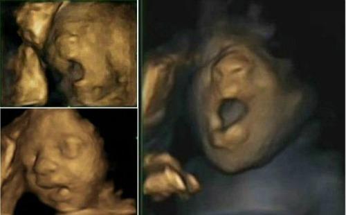 Los bebés bostezan dentro del vientre materno