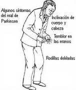 ¿Cuál es la actividad física idónea para un enfermo de Parkinson?