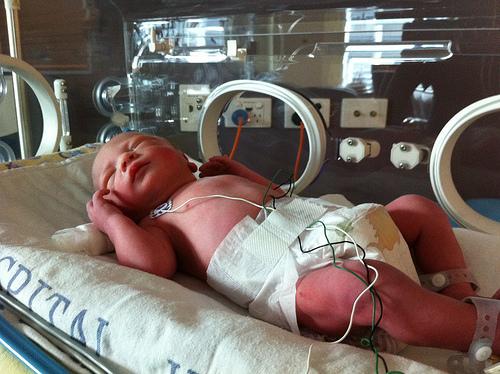 Drenar el cordón umbilical beneficia al recién nacido