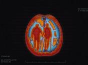 ocurre cerebro cuando química otra persona CURIOSIDADES