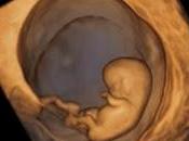 Amenaza aborto: ¿qué debo saber?