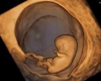 AMENAZA DE ABORTO: ¿QUÉ DEBO SABER?