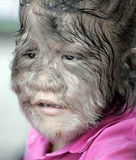 Ambras, pelos y frikis