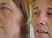 fumadoras abandonan hábito pueden sumar diez años vida