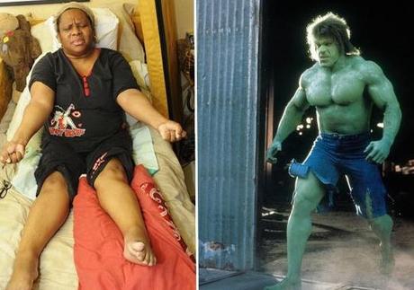 La mujer que se convierte como Hulk – NOTICIAS DE MIEDO