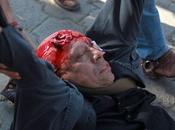 Juan Francisco Coydenall, años edad gravemente herido durante protestas imposición