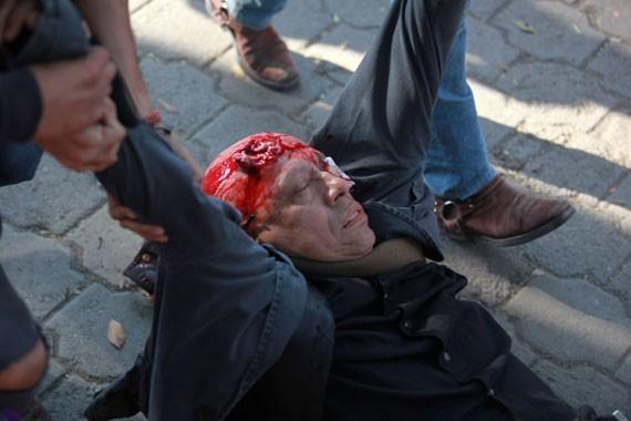Juan Francisco Coydenall, de 65 años de edad gravemente herido durante protestas ant imposición EPN
