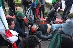 Llamado urgente para que los lesionados tengan mejor atención medica en especial Juan Francisco Quinquedal (Kuy)