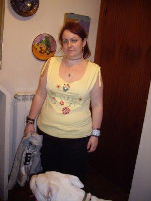 Mi aniversario de Bypass gástrico, 4 años, un gran cambio en mi vida