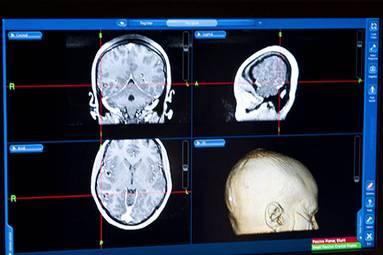 Desde el quirófano y en tiempo real hasta las redes sociales 20121205135225-un-hospital-transmitio-via-redes-sociales-la-extraccion-de-un-tumor-cerebral-1.jpg