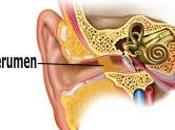 Procedimientos para limpieza cerumen oídos