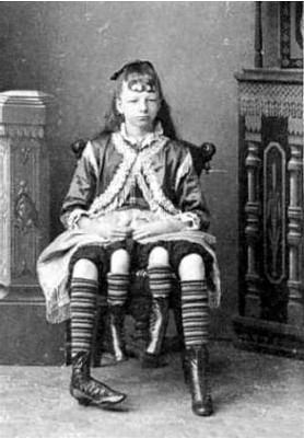 Myrtle Corbin, La mujer de las cuatro piernas
