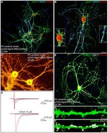 Crean neuronas a partir de otras células del cerebro ...