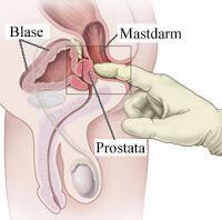Prostatitis.