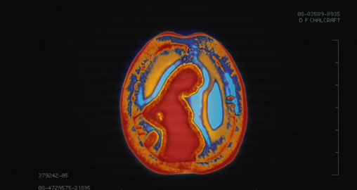 Un vistazo a los recuerdos