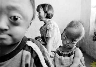 EEUU y genocidio del agente naranja / Orange agent in Vietnam