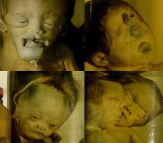 EEUU y genocidio del agente naranja / Orange agent in Vietnam