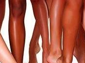 Remedios naturales para reducir varices arañitas