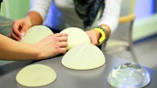 Mujeres portadoras de prótesis PIP asistieron a la sede de la Defensoría de Pueblo.