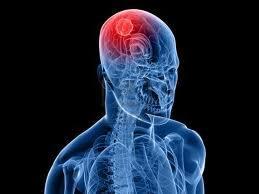 Avances para el tratamiento de tumores cerebrales