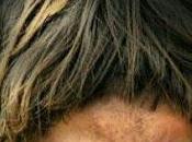 Luis muiño, psicologo: padres insultar hijos partido"... quien doctor?