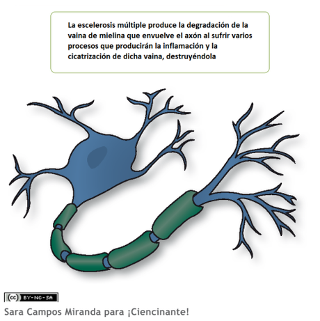 esclerosis-multiple-neurona-mielina