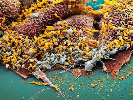 Intestinal Bacteria :: fotos microscópicas