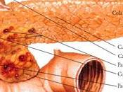 posibles causas para sufrir pancreatitis