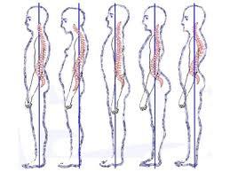 p155 Técnicas para mejorar la postura y evitar el dolor de espalda