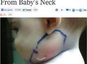 Bebe siete meses expulsa rostro metal centímetros