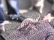 Crisis crónica repetida como síntoma epilepsia generalizada