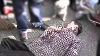 Crisis crónica y repetida como síntoma de una epilepsia generalizada